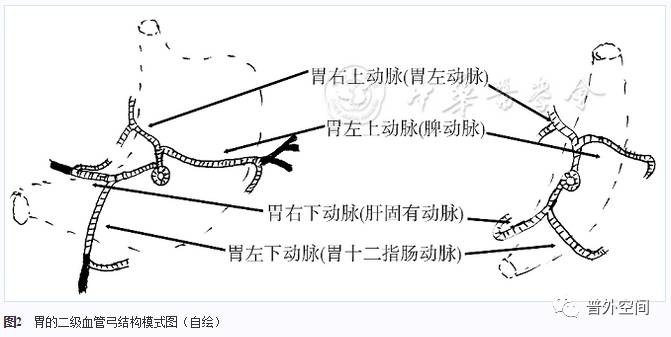 全胃切除是胃癌根治术吗,胃全切可以治愈胃癌吗