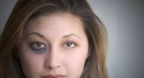 Madam问答室丨清洁面膜，黑眼圈怎么去，身体磨砂膏，内分泌失调，好穿的内衣？