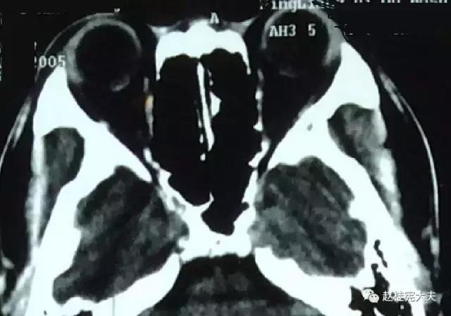 mri和核磁共振检查有什么区别,mri检查和核磁共振有区别吗