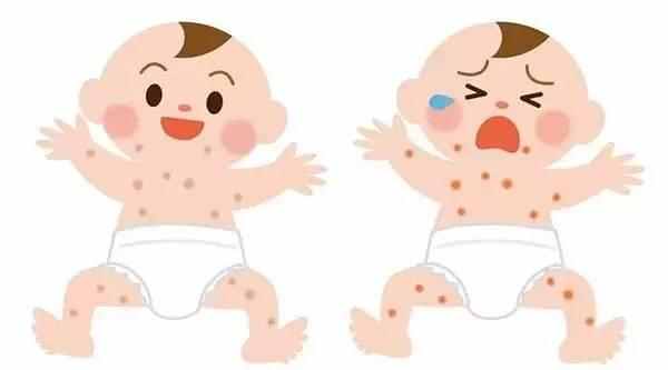 宝宝湿疹的原因及解决方法,宝宝得湿疹了怎么办及注意什么