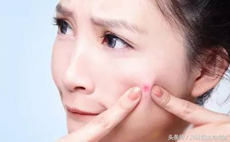 治疗青春痘套路,治疗青春痘最新视频