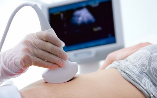 取节育环的最佳时间和注意事项,节育环不取后果