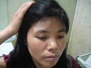 uvb和308治疗白癜风哪个效果好,家用308治疗白癜风哪个品牌好