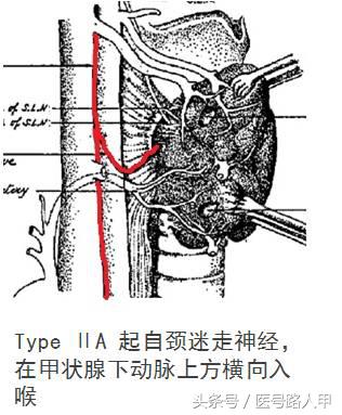 喉返神经的解剖视频,损伤喉上神经和喉返神经的区别