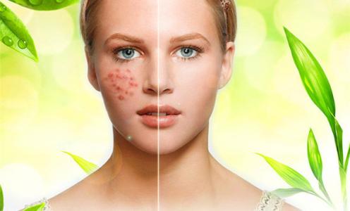 乱用护肤品皮肤成了激素脸,美容护肤导致毁容的心理原因