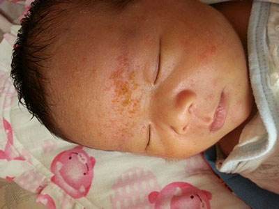 宝宝出现这些生理“异常”现象，你被哪个吓到了？