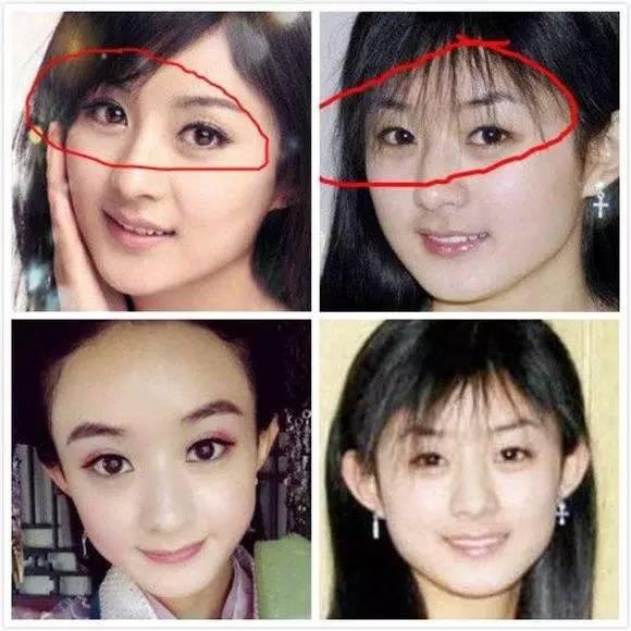 双眼皮怎么割没肉条感,双眼皮怎么显得更宽