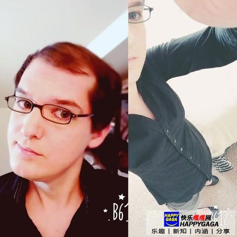 雌激素治脱发,雄性激素脱发补充雌性激素有用吗