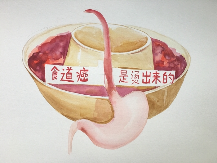 饮食预防癌症诀窍和防癌措施,饮食防癌症的建议有哪几种