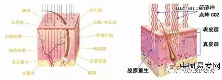 简单又好看的雀斑妆,雀斑妆需要很大胆的尝试
