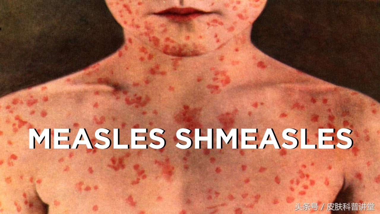 皮肤科普健康知识讲座,皮肤科普视频