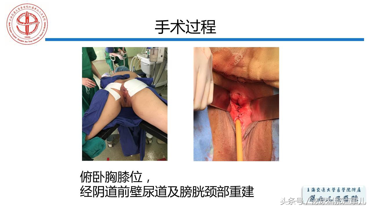 泌尿男科王忠教授,泌尿外科专家王忠教授