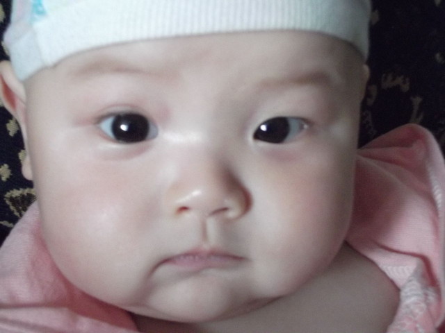 六个月宝宝感染水痘,六个月宝宝出水痘发烧了怎么办