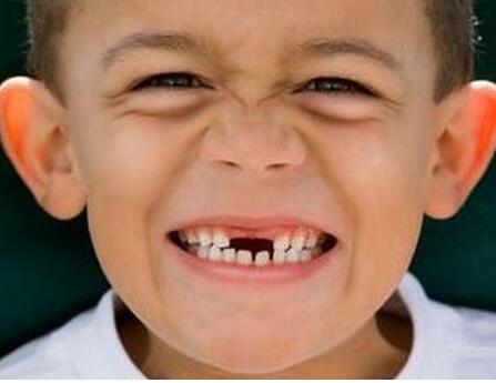 周公解梦梦到自己的门牙掉了,周公解梦梦见自己门牙掉了