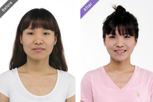 婴儿肥减肥能瘦下来吗,婴儿肥能通过运动瘦下来吗