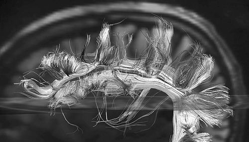 大脑袋,大脑大数据