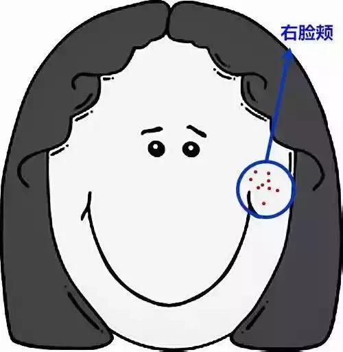 痘痘里挤出来的白色的痘痘怎么办,手臂上有很多痘痘挤出来是白色的