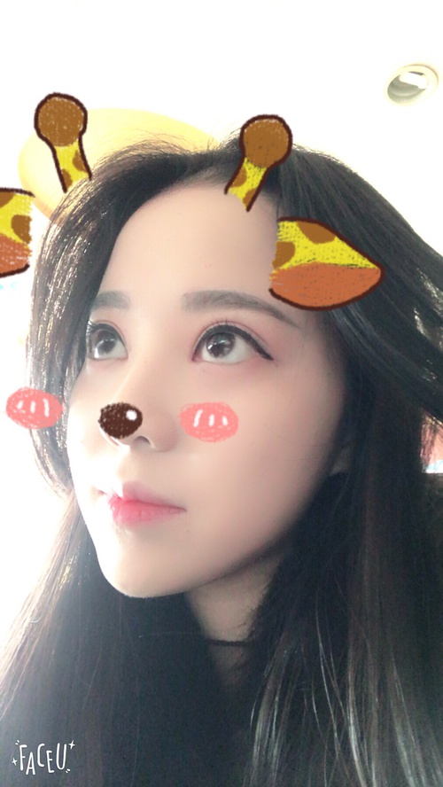 全切双眼皮疤痕增生多久可以恢复,全切双眼皮恢复过程经历真实