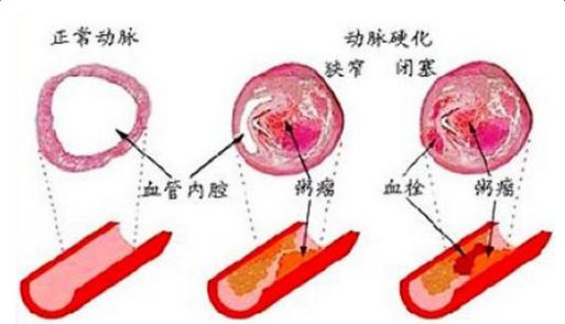 一条腿都肿了还胀怎么回事,一条腿肿的厉害