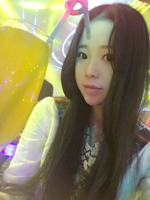 全切双眼皮疤痕增生多久可以恢复,全切双眼皮恢复过程经历真实