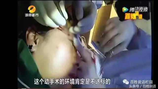 微整形乱象的解决对策,非法行医微整形纠纷