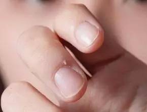 四岁女孩手指被截,一个女生下意识的小动作