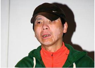 最容易得这4种病,可能是4种病在作怪别大意