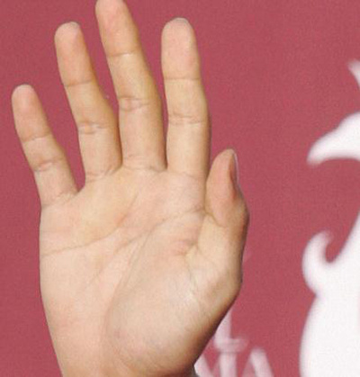 手控党的手长什么样子,手控党手背