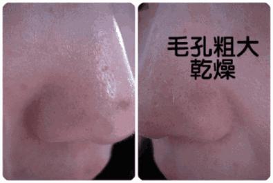 城野医生毛孔收敛水怎么用才有效,城野医生收缩毛孔水正确使用方法