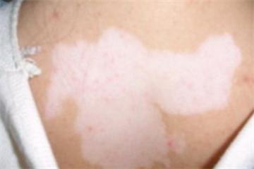 国足赢了嘛,国足赢了还会得癌症吗