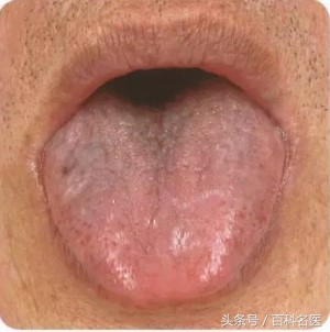 舌头舌诊,如何快速辨舌诊