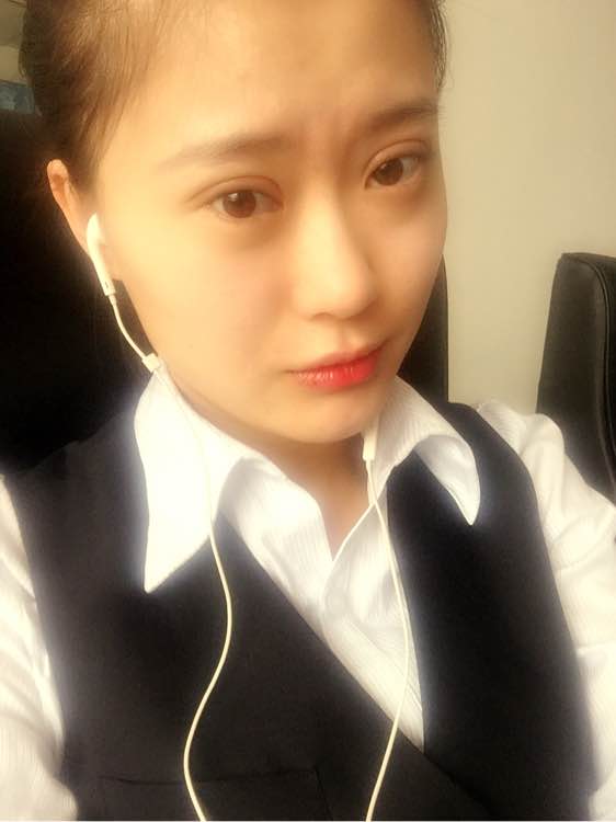 全切双眼皮一个月还是肿怎么回事,全切双眼皮一个月还肿是怎么回事