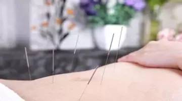 内分泌失调针灸什么穴位,针灸能治多囊和内分泌失调吗
