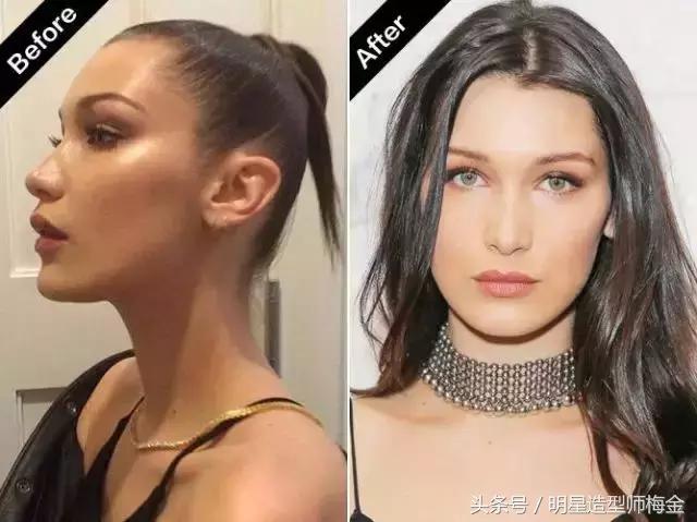 天生发量少怎么增多,天生发量少是缺什么