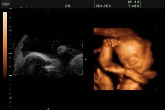 孕期各种不适已经悄然而生,孕期胎儿动得频繁与出生后性格