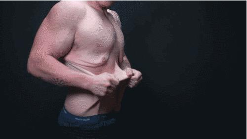 减肥瘦下来后肚子皮肤松弛怎么办,减肥瘦下来脸上皮肤松弛了怎么办