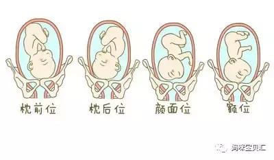 胎位不正导致难产首选的助产方法,胎位不正会有什么危险