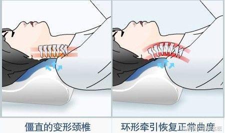 转脖子咔咔响肩颈痛,转脖子颈椎响怎么回事
