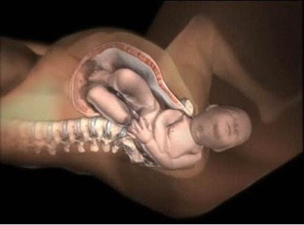 自然分娩讲解,自然分娩的三个产程