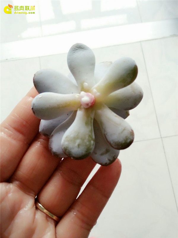 一个脚气患者的真实故事,关于癣有趣的故事