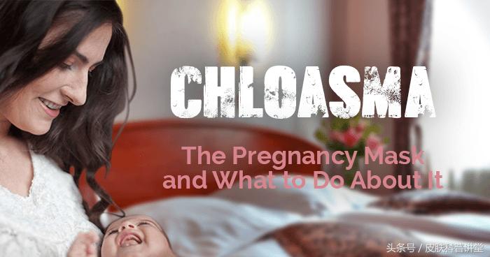 褐斑的原因和治疗方法,褐斑最佳治疗方法