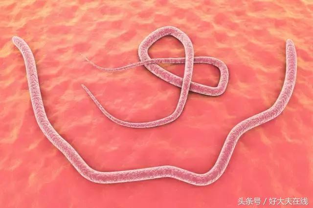 成人肚子里有蛔虫,成人如何治疗蛔虫