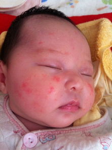 宝宝脸发痒起疙瘩怎么办,脸上奇痒无比什么原因