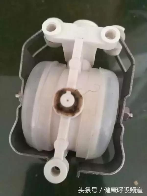 慢阻肺肺气肿的最佳治疗方法,肺气肿买什么样的呼吸锻炼仪好