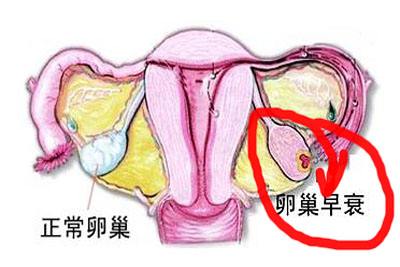 卵巢囊肿怎样自测最准确,卵巢自测试纸几个杠表示卵巢健康