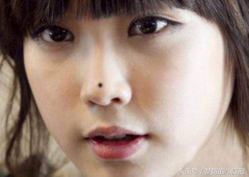 后肩膀痣相图解10大福痣,肩膀后痣相图解10大福痣