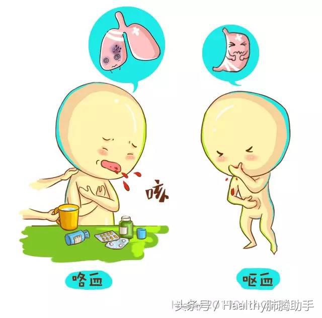 病人咳血什么体位,病人突发大咯血的急救措施