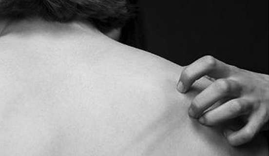 皮肤瘙痒长期吃激素药的危害,经常皮肤瘙痒是免疫力差吗