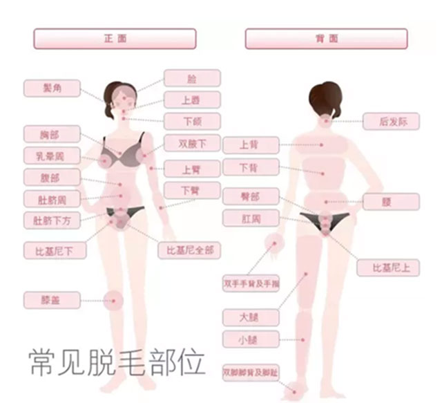 激光脱毛后的真实感受,激光脱毛一年后的真实感受