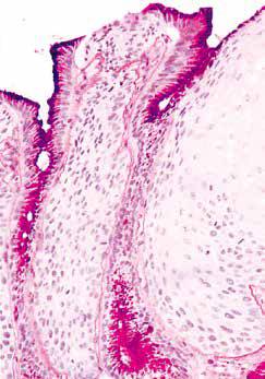 内镜做病理分析大概多久,作为一个医生太感性怎么办